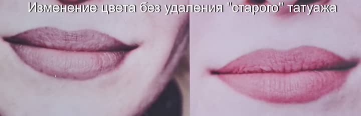  СДЕЛАНО ТРИ ПРОЦЕДУРЫ