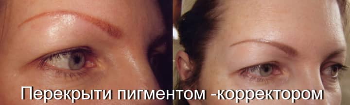 ИСПОЛЬЗОВАЛСЯ ПИГМЕНТ КОРРЕКТОР