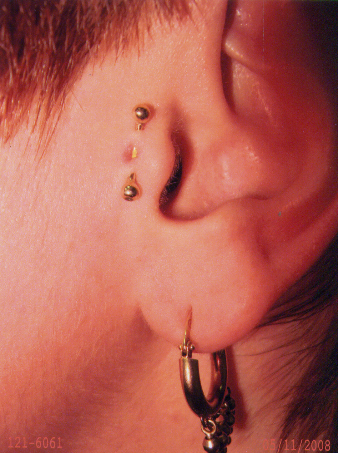 для возможного снижения аппетита